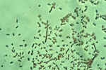 Photo of soil bacteria
